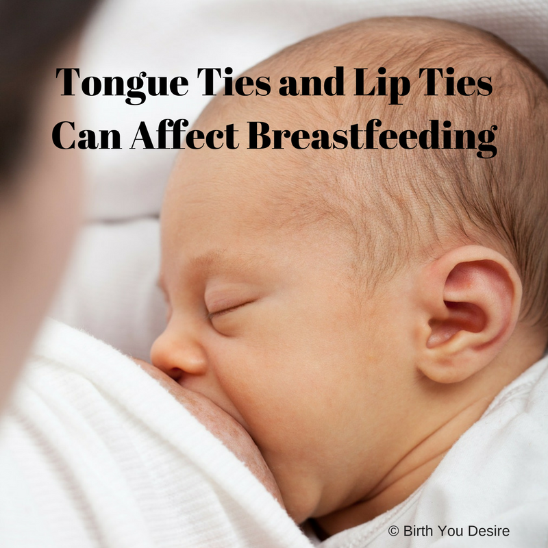 How Does Upper Lip Tie Affect Breastfeeding?