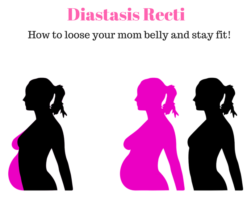 Losing your Mom Belly: What is Diastasis Rectus Abdominis?