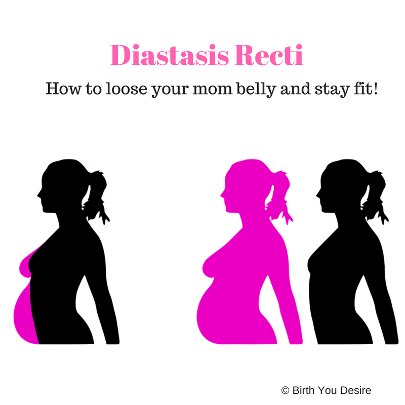 Diastasis Recti: How To Know If You Have It – Mommy Matters