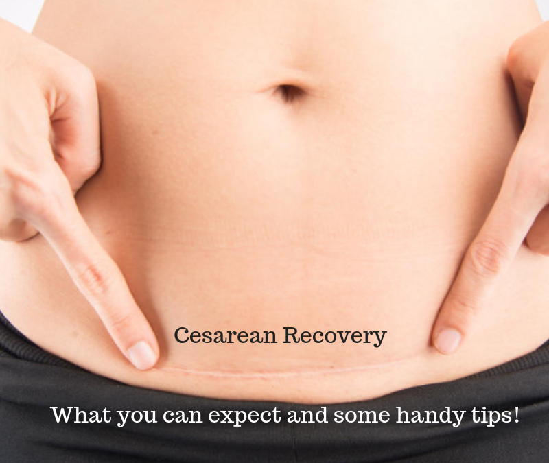 What You Can Expect During Your Cesarean Birth Recovery?
