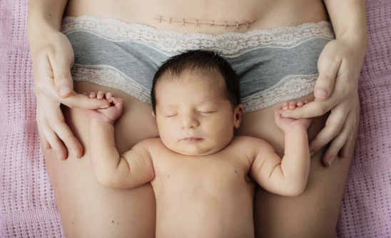 Your Cesarean Birth Step-by-Step: Don’t Fear the Unknown!