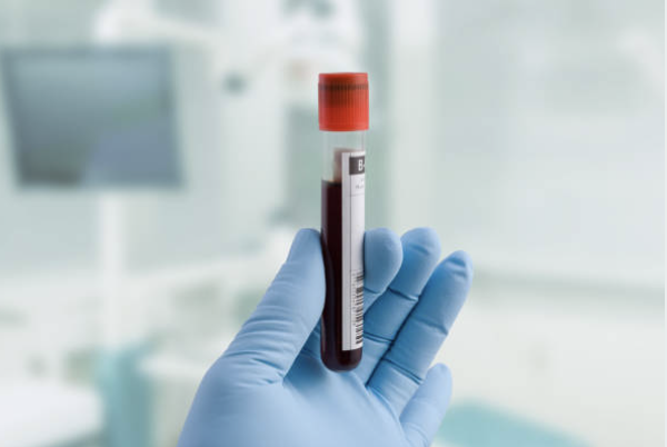 A gloved hand holding a blood vial holding cord blood